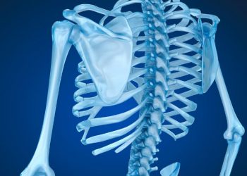 bone cancer