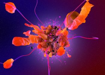 Appendix Cancer