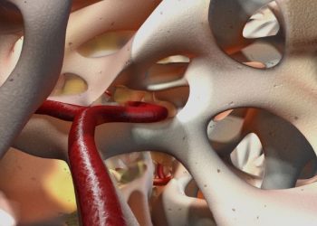 bone marrow cancer