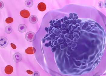 Laryngeal Cancer