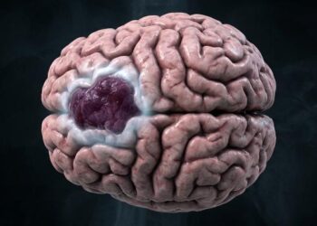 Glioma Brain Cancer